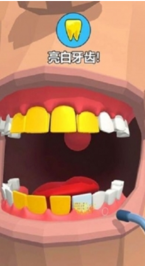 益智类游戏拔牙大师根据顾客牙齿的症状灵活应对的方法