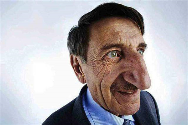 世界上谁的鼻子最大：土耳其男子鼻子长8.8厘米