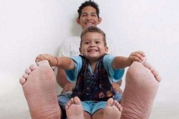 世界上脚最长最大的人：双脚长度都超过40厘米