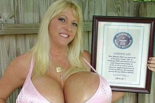 世界上最大的乳房：胸围154厘米，每个乳房重达9公斤