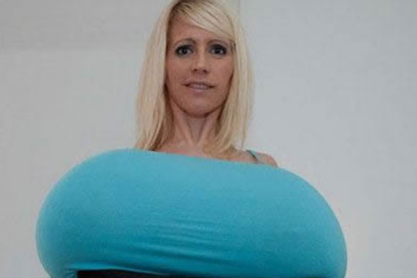 世界上最大的乳房：胸围154厘米，每个乳房重达9公斤