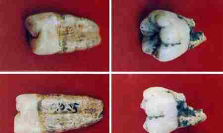 十大史前文明，1.3万年前人类就会补牙