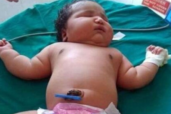 世界上最重的女婴，出生时体重达13.6斤