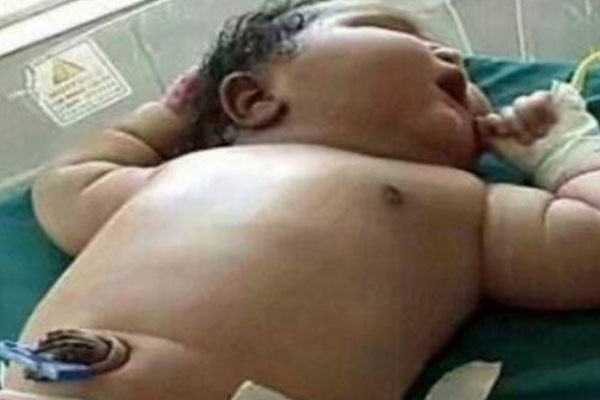 世界上最重的女婴，出生时体重达13.6斤